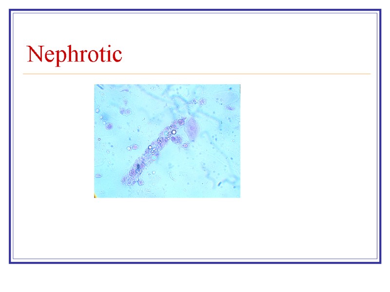 Nephrotic